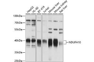 Western blot analysis of extracts of various cell lines, using NDUF antibody (123) at 1:1000 dilution. (NDUFA10 抗体  (AA 36-300))
