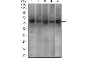 Western blot analysis using PDE1B mouse mAb against A549 (1), SK-MES-1 (2), PC-12 (4),3T3L1 (5) cell lysate and Mouse brain (3) tissue lysate. (PDE1B 抗体  (AA 370-536))