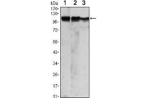 Western blot analysis using HK2 mouse mAb against Jurkat (1), Hela (2) and HEK293 (3) cell lysate.