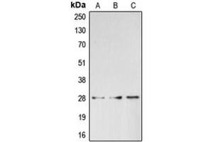 Western blot analysis of BRMS1 expression in HepG2 (A), HeLa (B), K562 (C) whole cell lysates. (BRMS1 抗体  (C-Term))