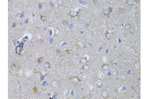 Immunohistochemistry of paraffin-embedded rat brain using MYH10 antibody. (MYH10 抗体  (AA 1908-2007))