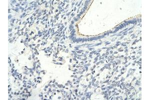 Immunohistochemistry (IHC) image for anti-General Transcription Factor IIF, Polypeptide 1, 74kDa (GTF2F1) (N-Term) antibody (ABIN2780397)