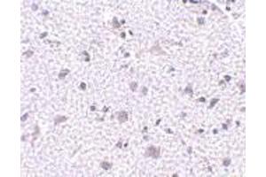 Immunohistochemistry of CDNF in human brain tissue with CDNF antibody at 5 μg/ml. (CDNF 抗体  (N-Term))