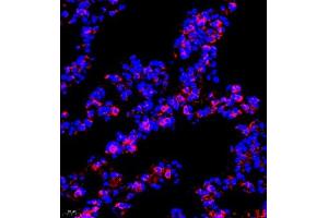 Immunofluorescence of paraffin embedded mouse lung using P4H (ABIN7074215) at dilution of 1:700 (400x lens) (HIF Prolyl Hydroxylase 抗体)