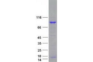 Validation with Western Blot