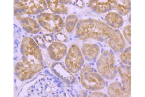 Paraformaldehyde-fixed, paraffin embedded human kidney section, Antigen retrieval by boiling in sodium citrate buffer (pH6) for 15min, Block endogenous peroxidase by 3% hydrogen peroxide for 30 minutes, Blocking buffer at 37°C for 20min, Antibody incubation with A-RAF (24D1) Monoclonal Antibody  at 1:50 overnight at 4°C, followed by a conjugated secondary and DAB staining. (ARAF 抗体)