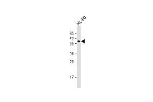 Anti-KLHL3 Antibody (Center) at 1:1000 dilution + HL-60 whole cell lysate Lysates/proteins at 20 μg per lane. (KLHL3 抗体  (AA 207-234))