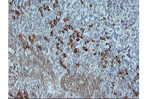 Image no. 2 for anti-Mitogen-Activated Protein Kinase 9 (MAPK9) antibody (ABIN1498927) (JNK2 抗体)