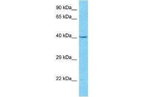 Host:  Rabbit  Target Name:  PSMD6  Sample Type:  MCF7 Whole Cell lysates  Antibody Dilution:  1. (PSMD6 抗体  (N-Term))