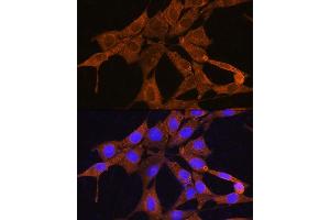 Immunofluorescence analysis of NIH/3T3 cells using NMN Rabbit pAb (ABIN7268910) at dilution of 1:100. (NMNAT3 抗体  (AA 1-215))