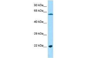 Host: Rabbit Target Name: MRPL4 Sample Type: HepG2 Whole Cell lysates Antibody Dilution: 1. (MRPL4 抗体  (N-Term))