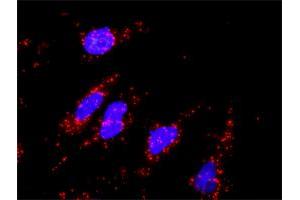 Proximity Ligation Analysis of protein-protein interactions between DKK1 and CTNNB1. (DKK1 抗体  (AA 1-266))