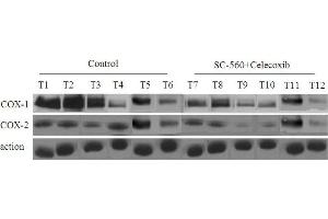 COX protein levels in xenograft tumors of nude mice treated or not treated with combined treatment of SC-560 and celecoxib. (PTGS1 抗体  (AA 151-250))