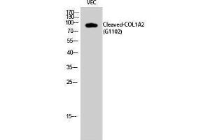 Western Blotting (WB) image for anti-Collagen, Type I, alpha 2 (COL1A2) (cleaved), (Gly1102) antibody (ABIN3181801)