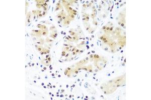 Immunohistochemistry of paraffin-embedded human stomach using AGO2 antibody at dilution of 1:100 (40x lens). (AGO2 抗体)