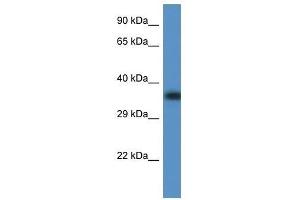 Western Blot showing Fbxo32 antibody used at a concentration of 1. (FBXO32 抗体  (C-Term))