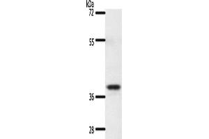 Gel: 10 % SDS-PAGE, Lysate: 60 μg, Lane: Mouse thymus tissue, Primary antibody: ABIN7192661(SSTR5 Antibody) at dilution 1/350, Secondary antibody: Goat anti rabbit IgG at 1/8000 dilution, Exposure time: 20 seconds (SSTR5 抗体)