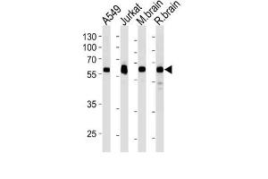 Western Blotting (WB) image for anti-Ubiquitin Specific Peptidase 14 (USP14) antibody (ABIN3004701) (USP14 抗体)