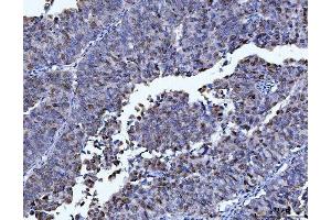 IHC analysis of FEN1 using anti-FEN1 antibody (ABIN7601619).