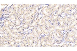 Detection of SAP in Rat Kidney Tissue using Polyclonal Antibody to Serum Amyloid P Component (SAP) (APCS 抗体  (AA 22-222))