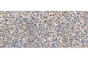 Immunohistochemistry of paraffin-embedded Human tonsil tissue using APOBR Polyclonal Antibody at dilution of 1:35(x200) (APOBR 抗体)