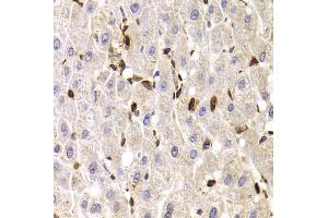 Immunohistochemistry of paraffin-embedded human liver injury using SPN antibody (ABIN5973813) at dilution of 1/100 (40x lens). (CD43 抗体)