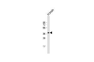 Anti-CEAC Antibody (N-term) at 1:1000 dilution + human brain lysate Lysates/proteins at 20 μg per lane. (CEACAM18 抗体  (N-Term))