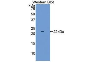 Detection of Recombinant LAMC2, Human using Polyclonal Antibody to Laminin Gamma 2 (LAMC2) (LAMC2 抗体  (AA 28-196))