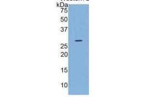 WB of Protein Standard: different control antibodies  against Highly purified E.