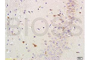 Formalin-fixed and paraffin-embedded mouse brain labeled with Rabbit Anti-Versican Polyclonal Antibody, Unconjugated (ABIN741660) 1:200 followed by conjugation to the secondary antibody and DAB staining (Versican 抗体  (AA 3301-3396))