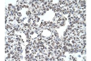 TMPRSS11D antibody was used for immunohistochemistry at a concentration of 4-8 ug/ml to stain Alveolar cells (arrows) in Human Lung. (TMPRSS11D 抗体  (N-Term))