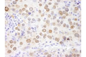 Immunohistochemistry (IHC) image for anti-High Mobility Group Nucleosome Binding Domain 1 (HMGN1) (AA 90-100) antibody (ABIN7448975)