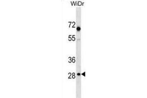 Western Blotting (WB) image for anti-Sorting Nexin 11 (SNX11) antibody (ABIN3000505) (SNX11 抗体)