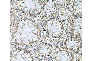 Immunohistochemistry (Paraffin-embedded Sections) (IHC (p)) image for anti-Protein Tyrosine Phosphatase Type IVA, Member 3 (PTP4A3) antibody (ABIN7260045)