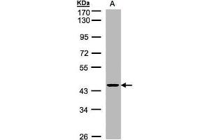WB Image Sample(30 ug whole cell lysate) A:H1299 10% SDS PAGE antibody diluted at 1:1000 (ZNF134 抗体)