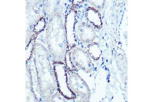 Western Blotting (WB) image for anti-ATP Synthase, H+ Transporting, Mitochondrial F1 Complex, beta Polypeptide (ATP5B) antibody (ABIN7265722)