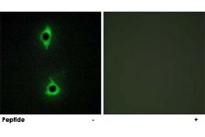 Immunofluorescence analysis of COS-7 cells, using PIKFYVE polyclonal antibody . (PIKFYVE 抗体)