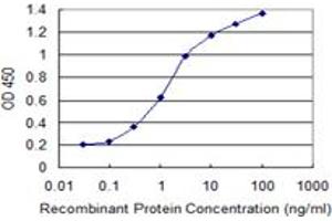 Detection limit for recombinant GST tagged SOX9 is 0. (SOX9 抗体  (AA 400-509))