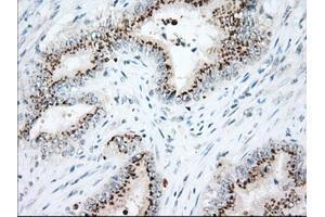 Immunohistochemistry (IHC) image for anti-Heat Shock 70kDa Protein 1A (HSPA1A) antibody (ABIN1498743) (HSP70 1A 抗体)