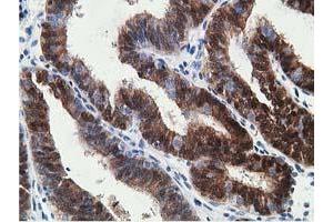 Image no. 3 for anti-Hydroxyprostaglandin Dehydrogenase 15-(NAD) (HPGD) antibody (ABIN1496361) (HPGD 抗体)