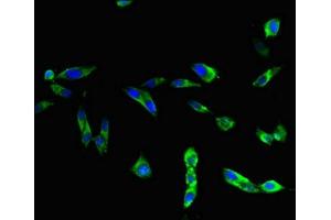 Immunofluorescent analysis of Hela cells using ABIN7172270 at dilution of 1:100 and Alexa Fluor 488-congugated AffiniPure Goat Anti-Rabbit IgG(H+L) (TLR3 抗体  (AA 135-297))