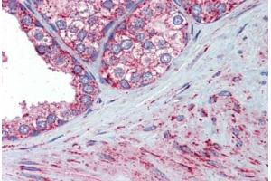 Prostate, Human: Formalin-Fixed, Paraffin-Embedded (FFPE) (SOD2 抗体)