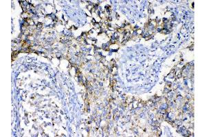 IHC analysis of SCF using anti-SCF antibody . (KIT Ligand 抗体  (AA 26-190))
