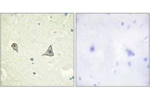 Immunohistochemistry analysis of paraffin-embedded human brain tissue, using M-CSF Receptor (Ab-723) Antibody. (CSF1R 抗体  (AA 691-740))