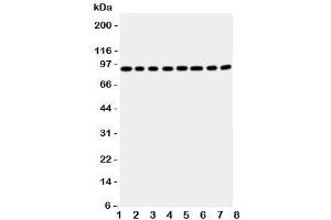 Western blot testing of Factor VIII antbody; Lane 1: A431;  2: HeLa;  3: SMMC-7721;  4: Jurkat;  5: Raji;  6: CEM;  7: HL-60;  8: MCF-7 cell lysate (Factor VIII 抗体  (Middle Region))
