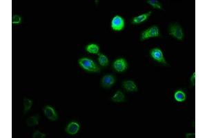 Immunofluorescence staining of A549 cells with ABIN7149631 at 1:100, counter-stained with DAPI. (DHRSX 抗体  (AA 32-330))