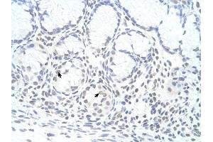 ZNF580 antibody was used for immunohistochemistry at a concentration of 4-8 ug/ml to stain Epithelial cells of fundic gland (arrows) in Human Stomach. (ZNF580 抗体  (N-Term))