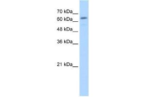 WB Suggested Anti-GUSB Antibody Titration:  2. (Glucuronidase beta 抗体  (C-Term))