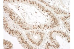 Immunohistochemistry (IHC) image for anti-X-Ray Repair Complementing Defective Repair in Chinese Hamster Cells 6 (XRCC6) (AA 559-609) antibody (ABIN7448626)