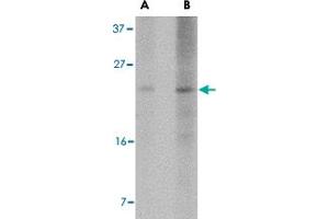 Western blot analysis of BBC3 expression in K-562 cell lysate with BBC3 monoclonal antibody, clone 2A8F6  at (A) 2. (PUMA 抗体  (AA 76-170))